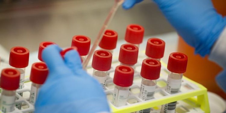 Respuesta al coronavirus en EEUU fue más lenta por error de los CCPE