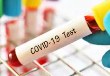 Oleada de pruebas para el COVID-19 no reguladas en Estados Unidos crea mucha confusión