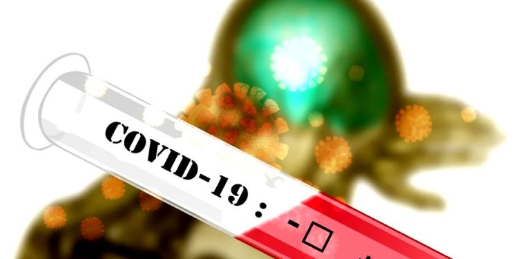 Francia reportó cifra récord de contagios diarios de coronavirus