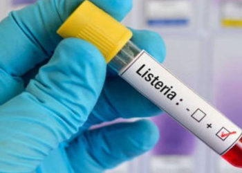 La listeria, dependiendo de cada paciente, puede ser benigna, o provocar hasta la muerte.