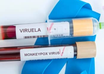Cambiar el nombre de un virus, que lleva 50 años etiquetado como viruela del mono, no modifica el estigma. Una campaña educativa sí.