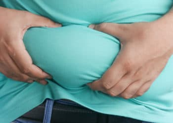 La obesidad es un problema de Salud Pública en EEUU. Foto cortesía Towfiqu barbhuiya / Unsplash.