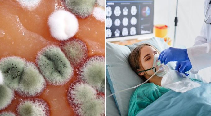 Los hongos causan una amplia gama de enfermedades, que pueden ser mortales.