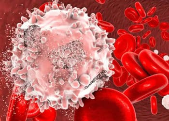 El nuevo medicamento experimental, Revumenib, ha logrado curar la leucemia avanzada en 18 pacientes.