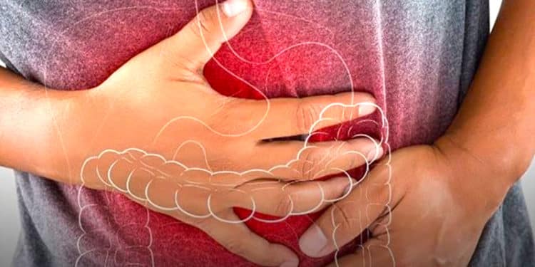 Son cada vez más jóvenes, los pacientes masculinos con cáncer colorrectal.