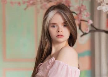 La modelo venezolana, Jessica Jacinto, utiliza su plataforma para marcar la diferencia, en un mundo de exclusión.