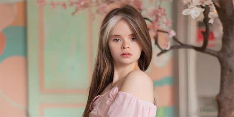 La modelo venezolana, Jessica Jacinto, utiliza su plataforma para marcar la diferencia, en un mundo de exclusión.