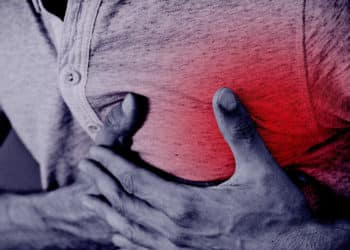 El ácido bempedoico baja el colesterol y es una opción de tratamiento prometedora, para pacientes con alto riesgo de infarto.